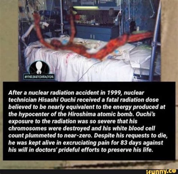 Hisashi Ouchi: A Survivor's Journey Through Radiation