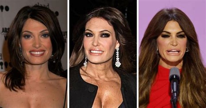 Kimberly Guilfoyle: Beauty, Politics, And The Plastic Surgery Rumors