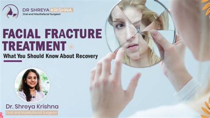 Understanding Ahna Face Fracture: A Journey Through Injury And Recovery