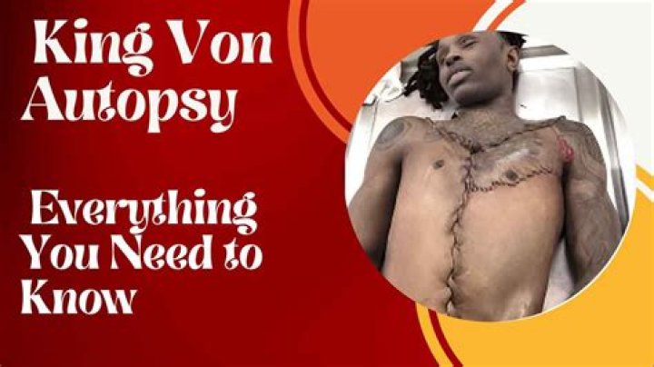 Unraveling The Mysteries Of Vons Autopsy: A Deep Dive