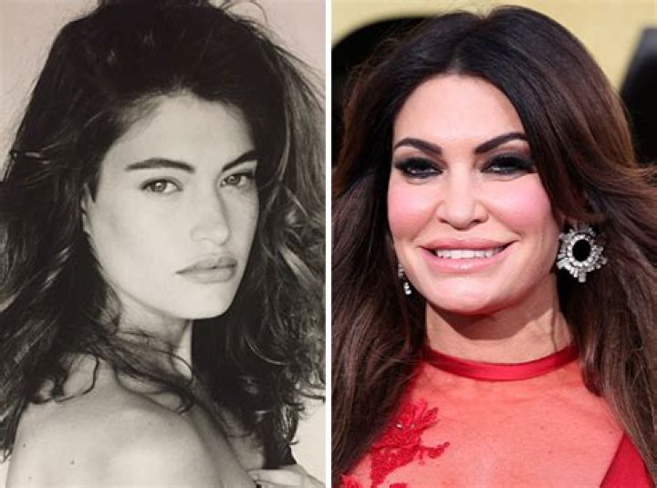 Unveiling The Transformation: Kimberly Guilfoyle's Facelift Journey