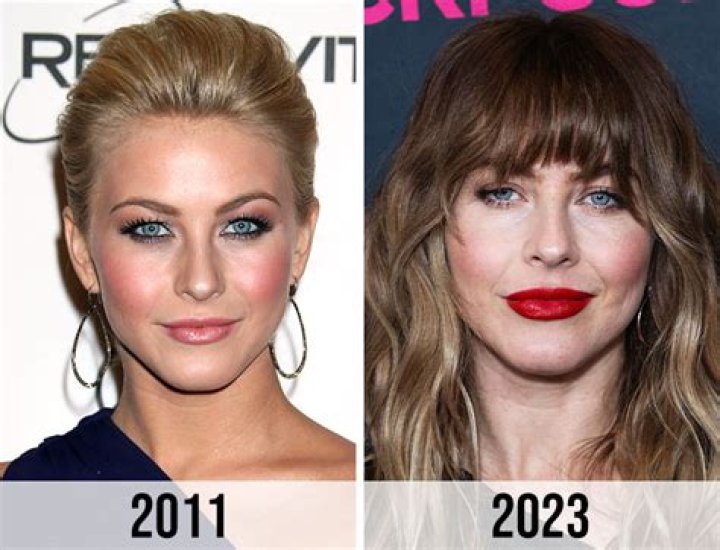 Unveiling The Truth: Has Julianne Hough Had Plastic Surgery?